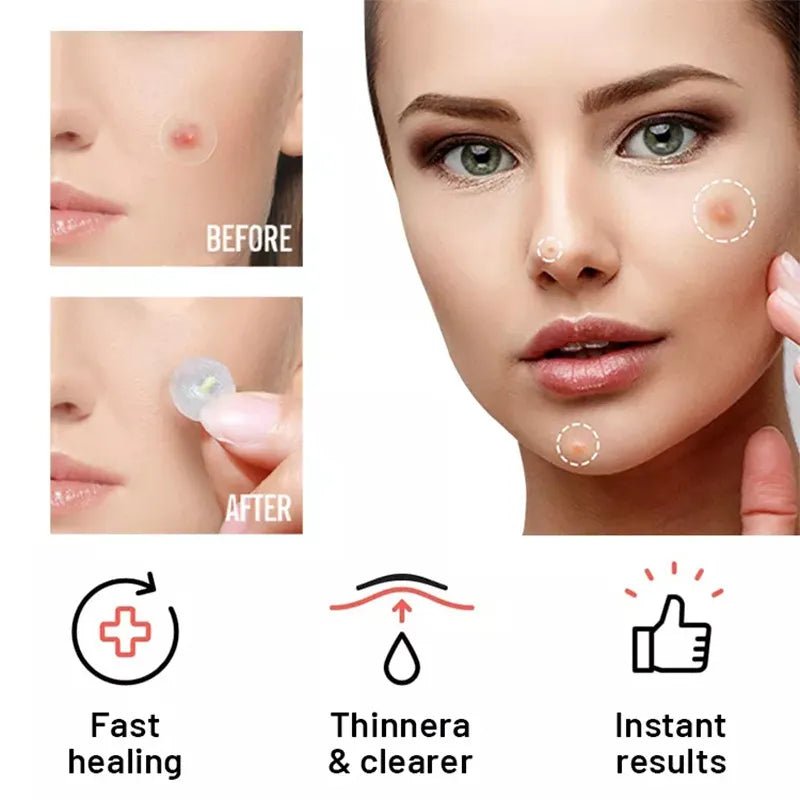 SootheMagical™ Patch - Soothe & Restore